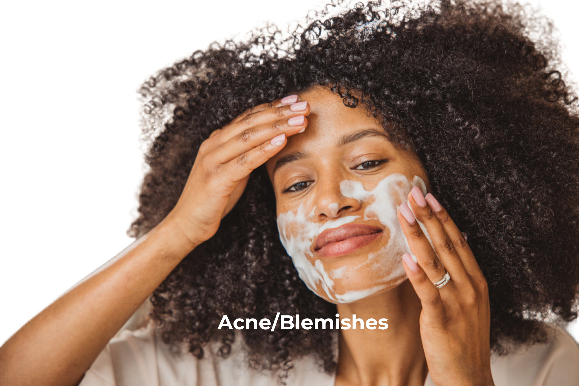Acne/Blemishes
